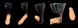 orthotics  prosthetics service fresno KMY Clinic