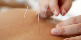acupuncturist fresno Star Acupuncture