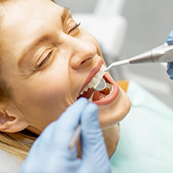 dentist glendale Absolute Dental Care