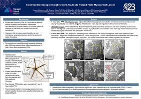Electron Microscopic Insights from An Acute Pulsed Field Myocardial Lesion (Iwanari Kawamura MD, et al)