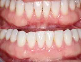 dental implants periodontist irvine Justine Hoda Hai DDS, MS