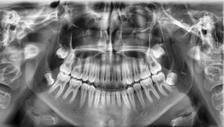 dental radiology irvine Mobile Dental Imaging - MDI