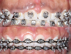 dental implants periodontist irvine Justine Hoda Hai DDS, MS