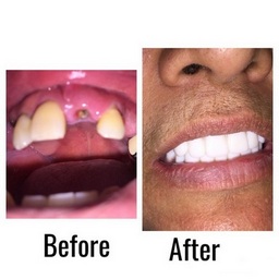 cosmetic dentist ontario Pacific Dental Smiles - Cosmetic Dentist Ontario Ca