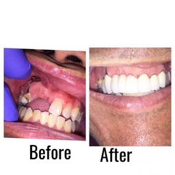 cosmetic dentist ontario Pacific Dental Smiles - Cosmetic Dentist Ontario Ca