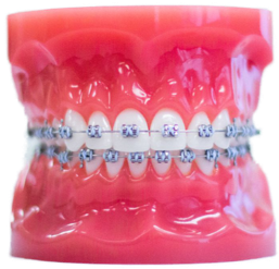 orthodontist pasadena Pasadena Orthodontics - Dr. Chan & Dr. Babaan