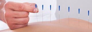 acupuncturist roseville Oriental Acupuncture