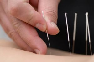 acupuncturists sacramento Way of the Phoenix Acupuncture