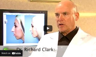 rhinoplasty plastic surgeons in sacramento Richard P. Clark M.D.