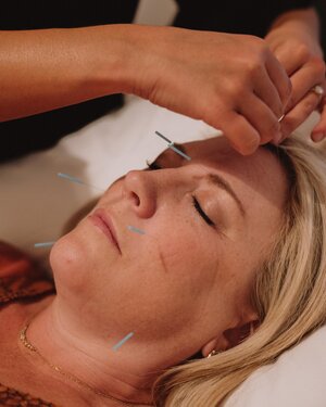 acupuncturists sacramento Better Balance Acupuncture + Wellness