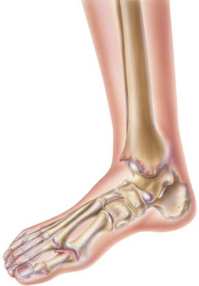 podiatrist salinas Salinas Valley Foot & Ankle