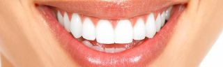 teeth whitening service san bernardino MGO Dental