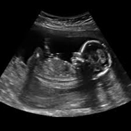 5d ultrasounds in san diego Mommy and Me 3D 4D Ultrasound