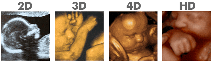 ultrasound clinics san diego Baby Wave 4D Ultrasound