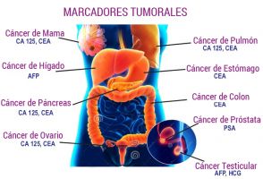 analisis indices tumorales san diego Laboratorio Qualli