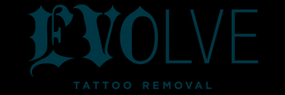 tattoo removal clinics san diego Evolve Tattoo Removal