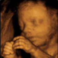 5d ultrasounds in san diego Mommy and Me 3D 4D Ultrasound