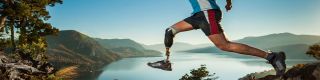 orthotics  prosthetics service stockton Capstone Prosthetics & Orthotics