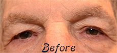 ophthalmologist thousand oaks Dr. Daniel A. Ebroon, MD