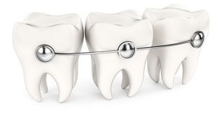 orthodontist torrance Orthodontics of Torrance