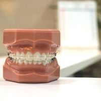 pediatric dentist vallejo Solano Smile Orthodontics & Pediatric Dentistry - Benicia