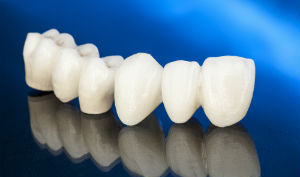 denture care center ventura Aloha Dental Care | Michael Harrington, DDS