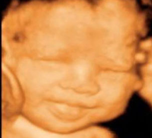 diagnostic center victorville 3D 4D Ultrasound by 4D Special Delivery