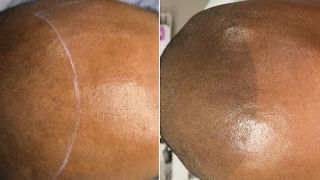 permanent make up clinic visalia Microblading by AngelaC - Scalp Micropigmentation